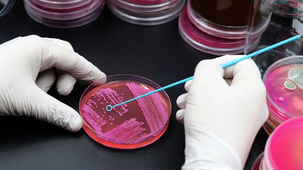 Mãos com luvas manuseando placa de Petri com colônias de microrganismos em meio de cultura, utilizando alça de inoculação azul durante experimento em microbiologia.